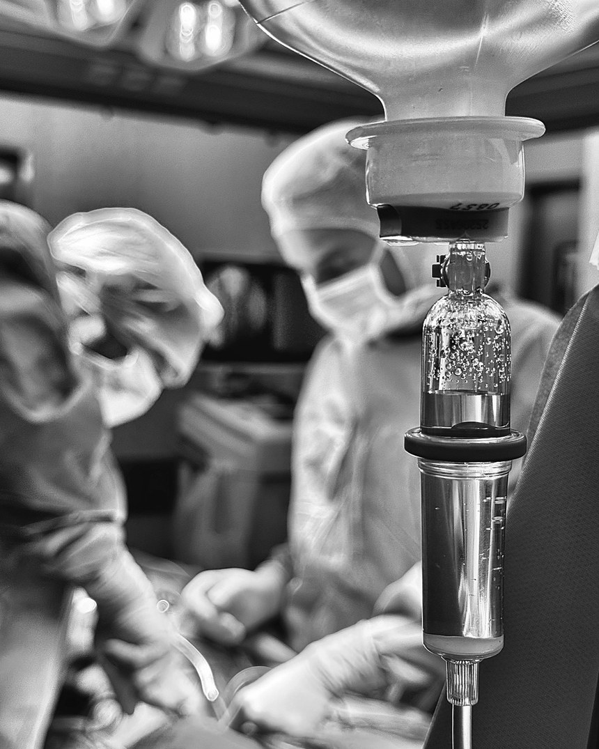 La perfusion préparée au bloc, avant le geste