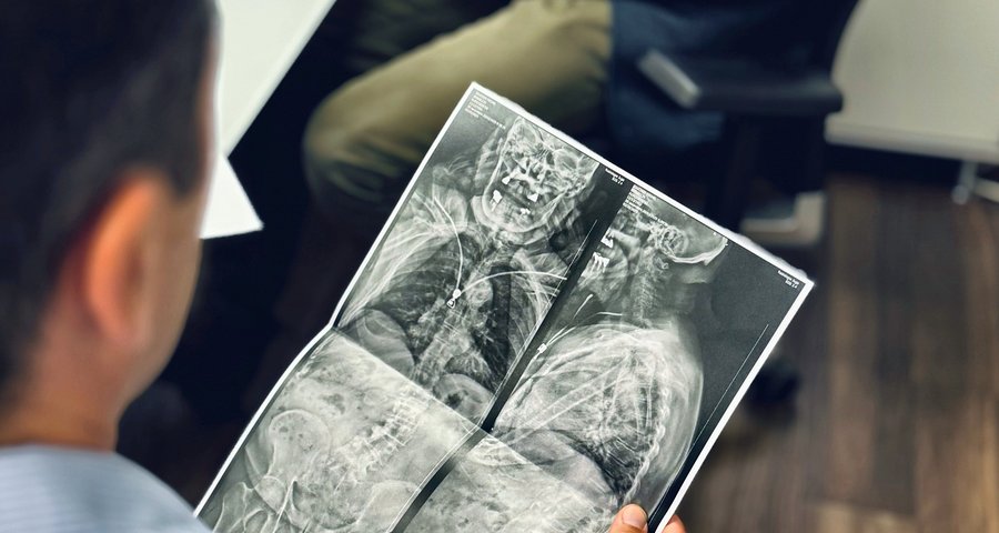 Un praticien étudie une radiographie de la colonne vertébrale