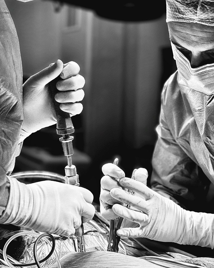 Les mains du chirurgien guidant l'instrument, au bloc opératoire