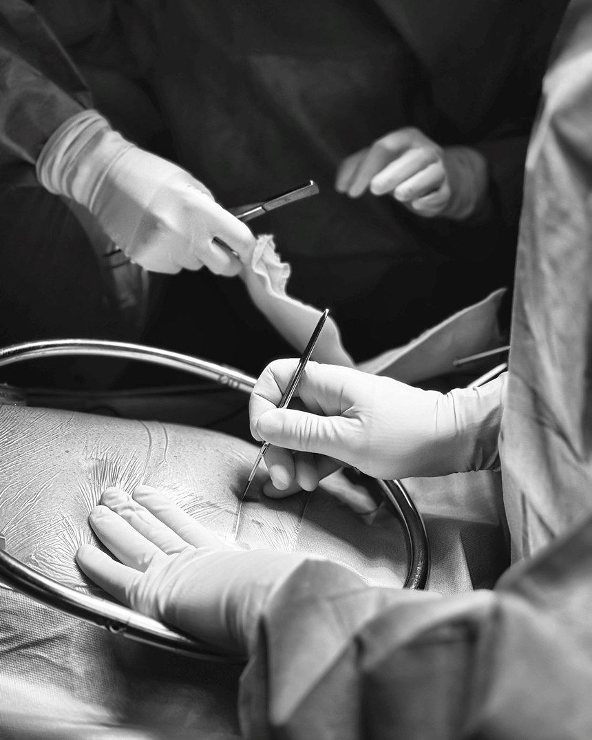 Les mains gantées du chirurgien au moment de l'incision, au bloc opératoire